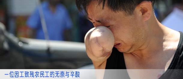 一位因工致残农民工的无奈与辛酸